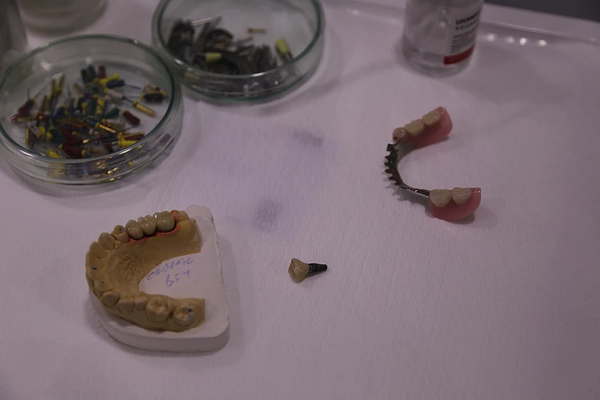 Beş kişinin öldürüldüğü cinayeti protez ve implant diş parçaları çözdü