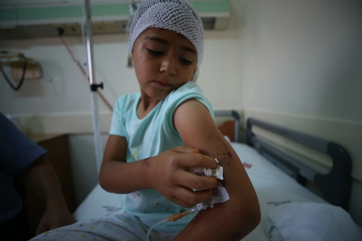 Pitbull Reyyan’ı öldürüyordu