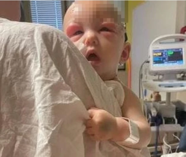 Bebek saç kurutma makinesi yüzünden kör oldu