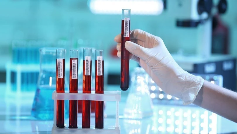 Talasemi Majör Nedir?