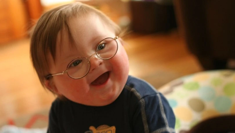 Yargıtay'dan Down Sendromlu çocukların ailelerine tazminat kararı