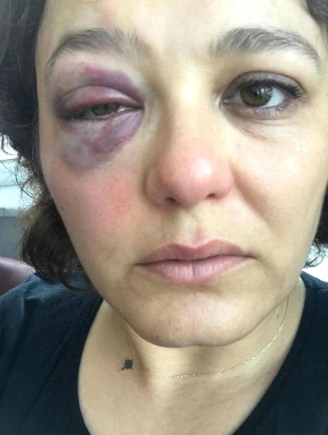 Kadıköy'de Saldırgan, "Senin Havan Kime" Deyip Restoranda Yemek Yiyen Kadına Yumruk Attı