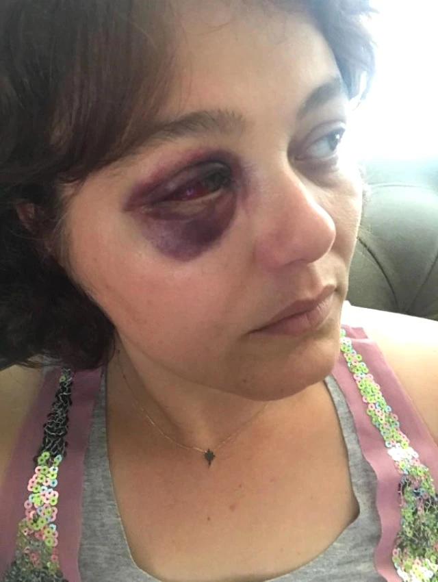 Kadıköy'de Saldırgan, "Senin Havan Kime" Deyip Restoranda Yemek Yiyen Kadına Yumruk Attı