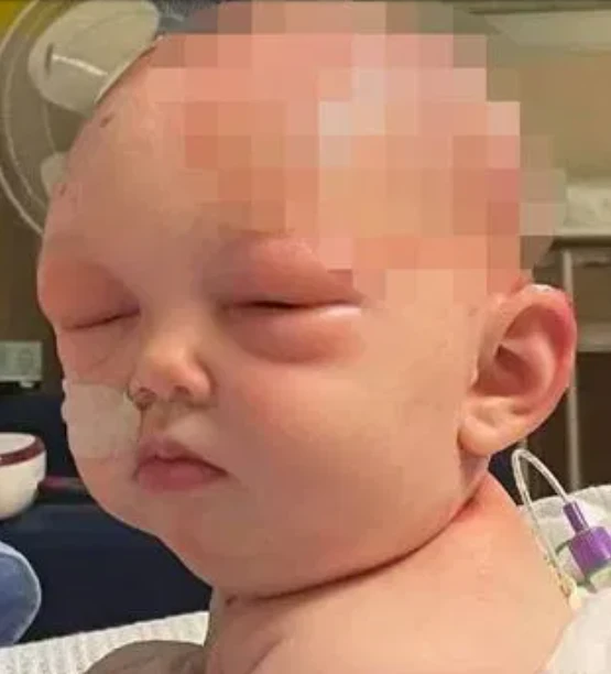 Bebek saç kurutma makinesi yüzünden kör oldu