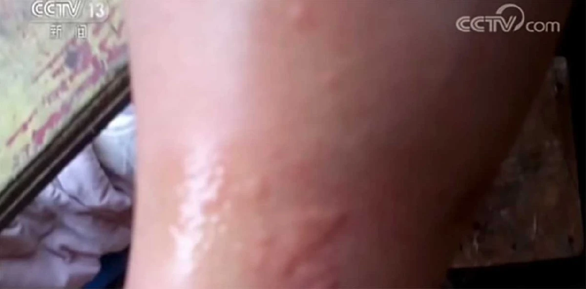 Yarasaların Wuhan'da uzmanları ısırdığı görüntüler ortaya çıktı