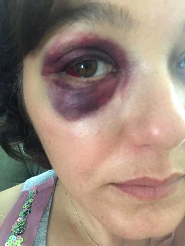 Kadıköy'de Saldırgan, "Senin Havan Kime" Deyip Restoranda Yemek Yiyen Kadına Yumruk Attı