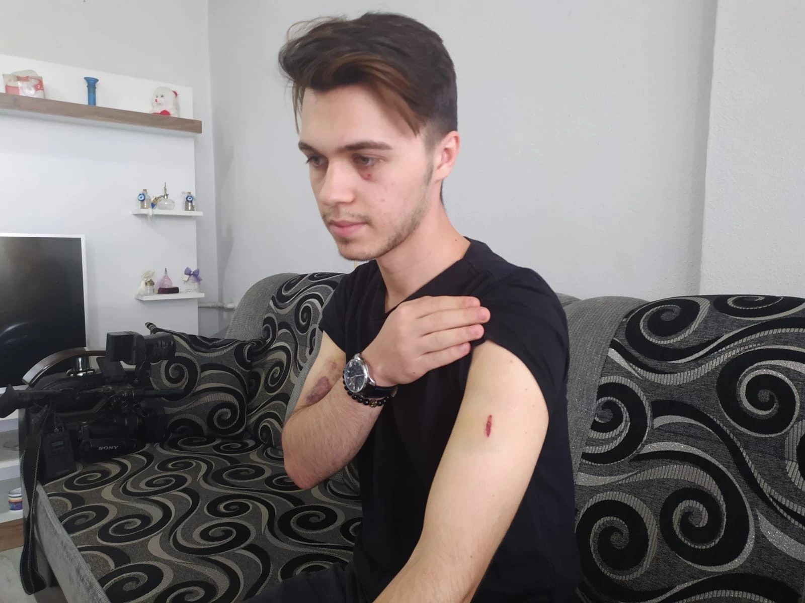 Arkadaşıyla parkta otururken sopalı saldırıya uğradı