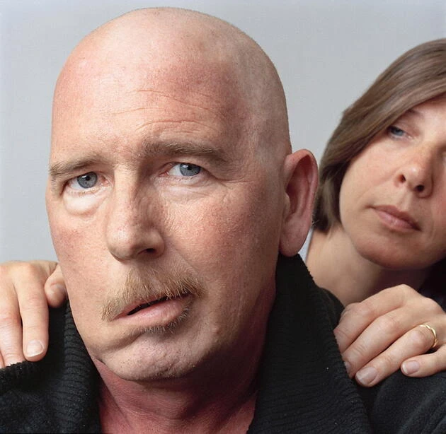 Yüz Felci Nedir? Yüz Felci Neden Olur? Yüz Felci Nasıl Tedavi Edilir?