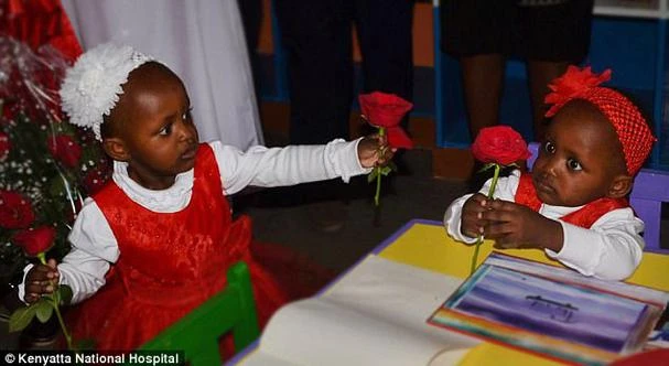 İkizleri ayırmak için 50 cerrah seferber oldu