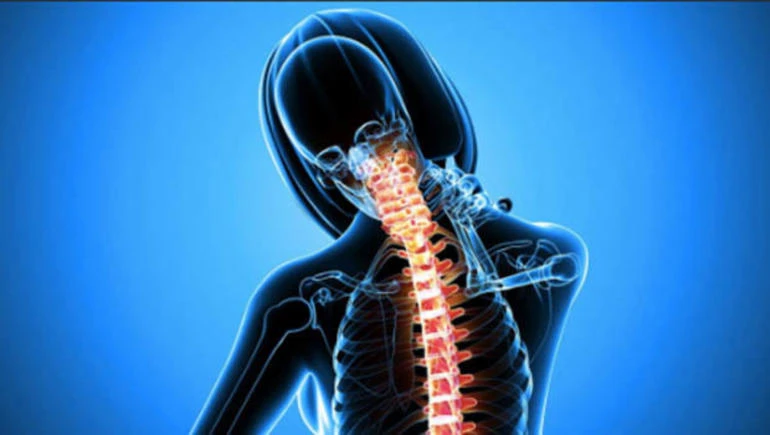 Geçmeyen sırt ağrıları ‘kamburluk’ habercisi olabilir