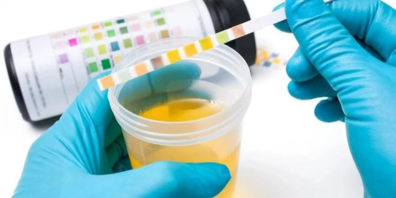 Üşütmek İdrar Yolu Enfeksiyonu Yapar mı? İdrar Yolu Enfeksiyonuna Ne İyi Gelir?