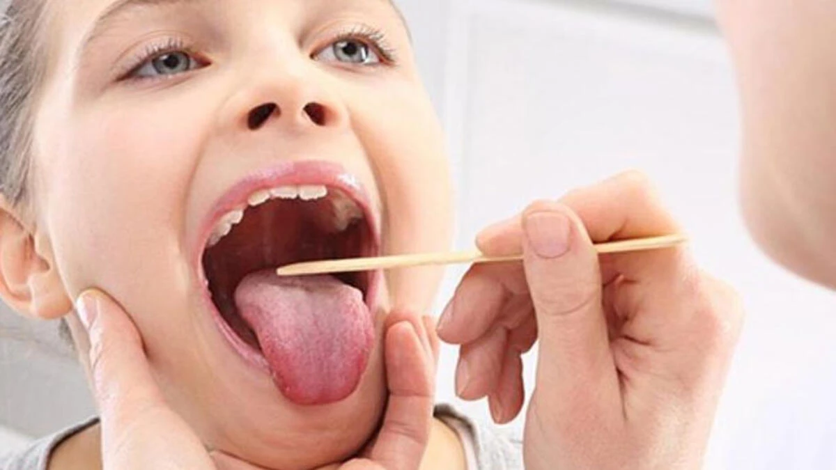 Bademcik Şişmesi Nasıl Geçer Evde? Farenjit - Boğaz İltihabı Nedir?