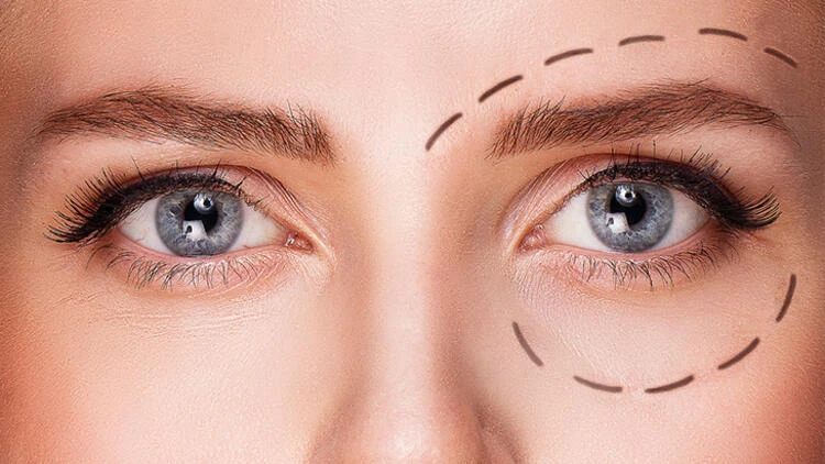 Göz estetiği ile genç görünmek elinizde