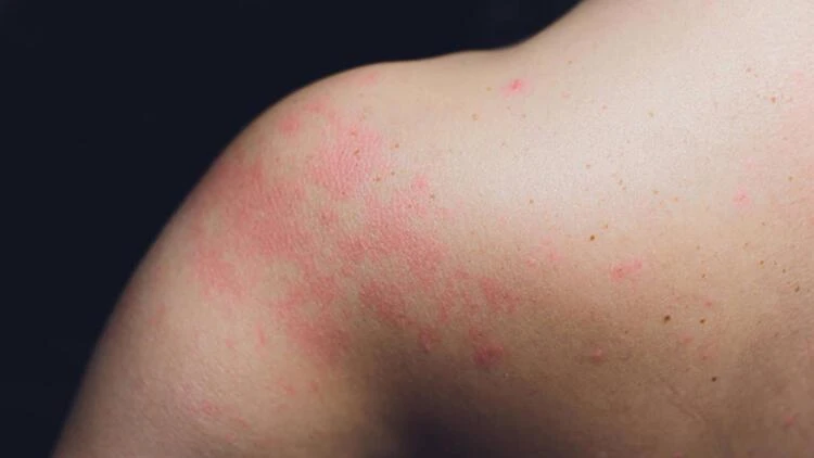 Koronavirüsün belirtileri yine değişti: İşte en sık görülen 21 semptom