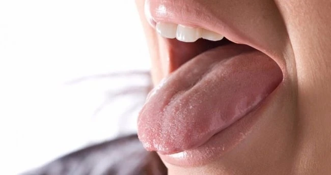 Dil hastalık ve yaraları nedir?/ Dil acıması neden olur?