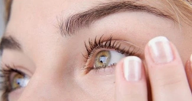 Göz Şişmesi Nasıl Geçer? Göz Şişkinliğine Ne İyi Gelir?