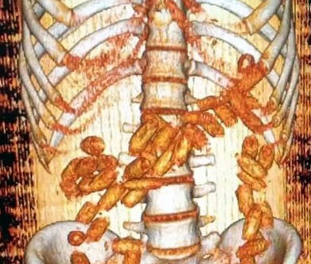 Brezilyalı kadın yolcunun midesinden çıktı