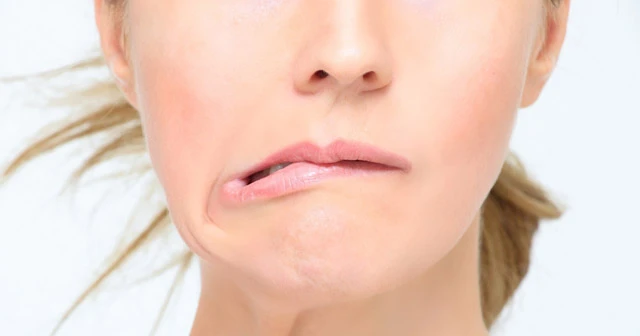 Soğuk hava ve rüzgâr yüz felcini tetikliyor