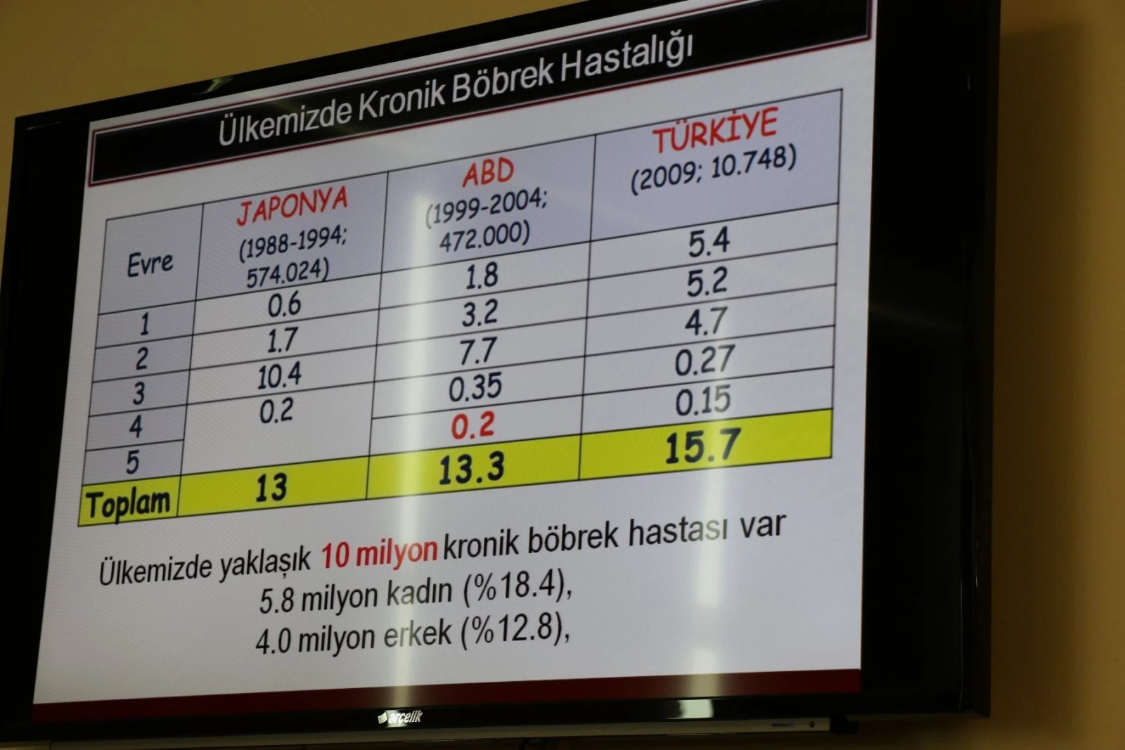 Böbrek hastalığında ürkütücü rakam: 10 milyon kişi hasta