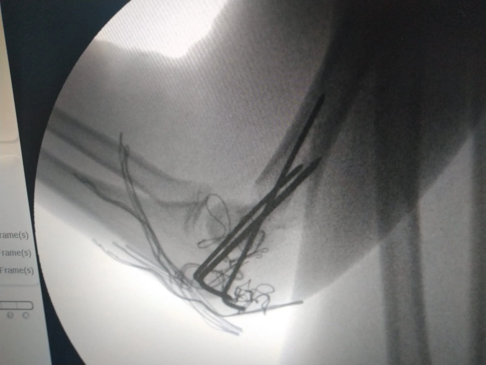 Yaptıkları ameliyat ile tıp literatürüne girdiler