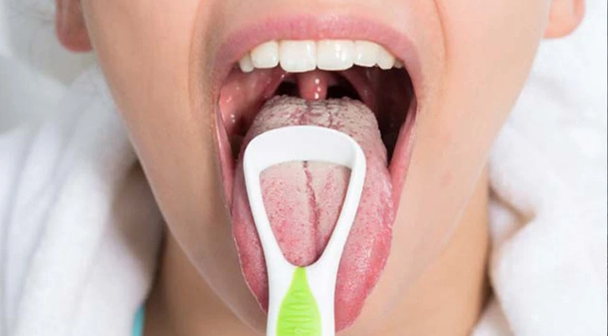 Dilden hastalık analizi nasıl yapılır? Dilden hastalık teşhisi yapılır mı?