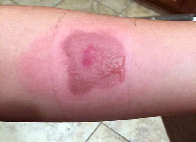 Sosyal medya çılgınlığına karşı uzmanlar uyardı