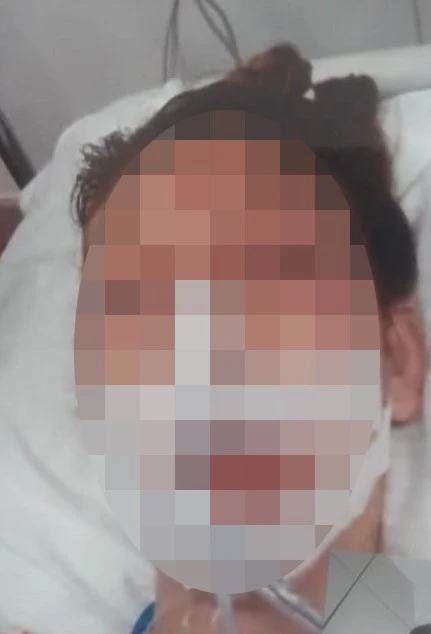 Zorla ormanlık alana götürdü, başına taşla vurarak ağır yaraladı