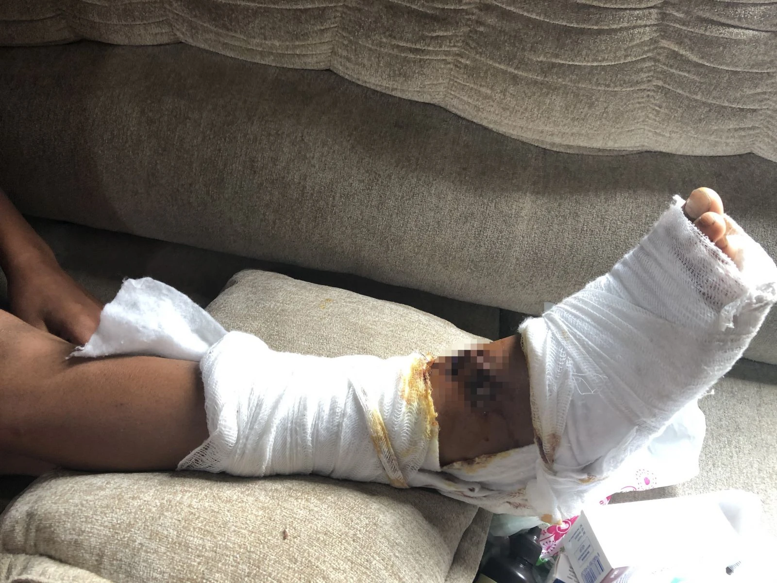 Pitbull 13 yaşındaki çocuğa dehşeti yaşattı