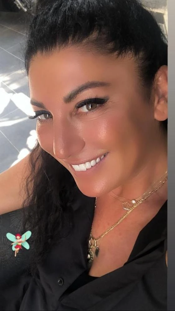 Gözaltı ışık dolgusu yaptırdı, hayatı karardı