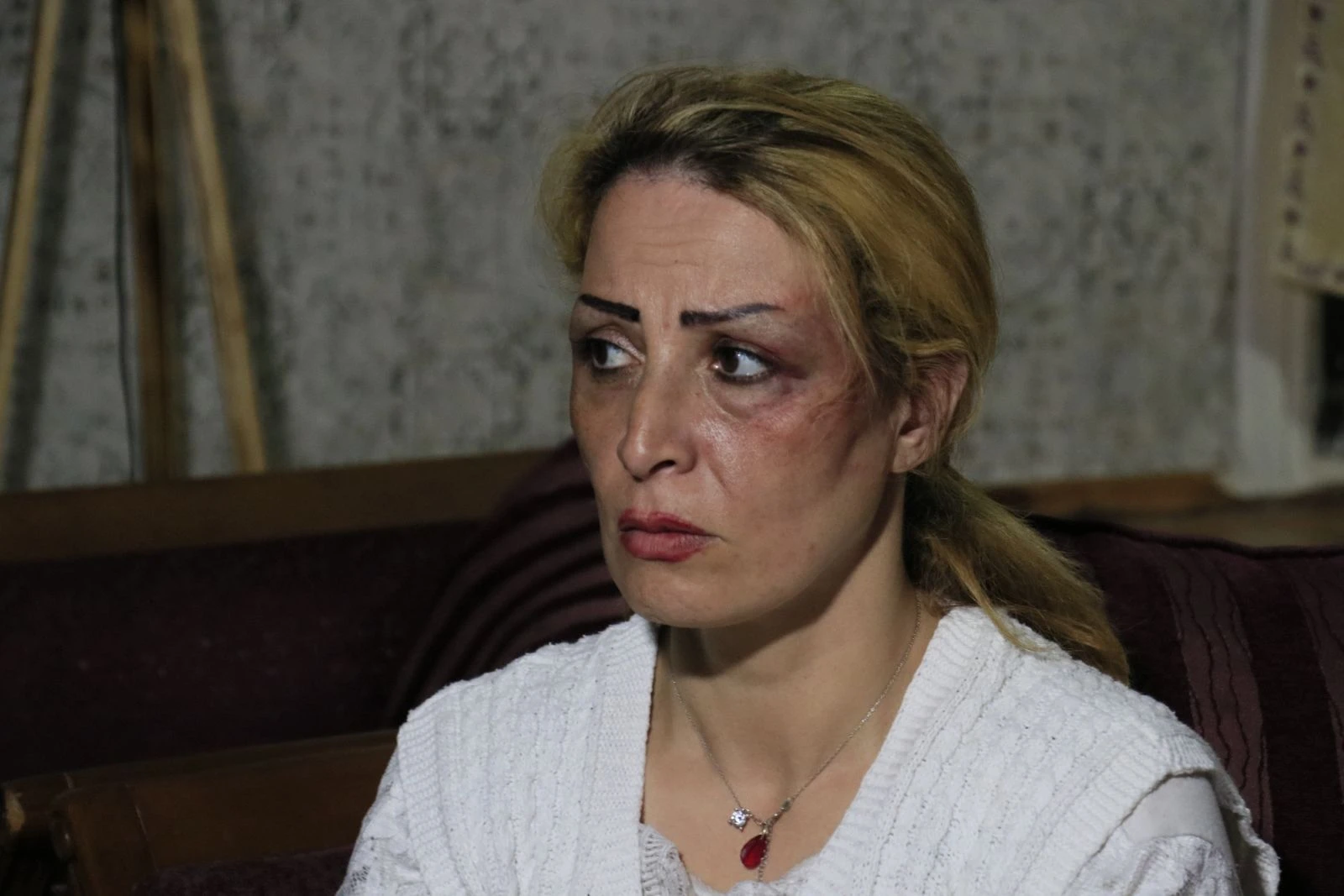 İranlı mimar kadın eşinden öldüresiye dayak yedi