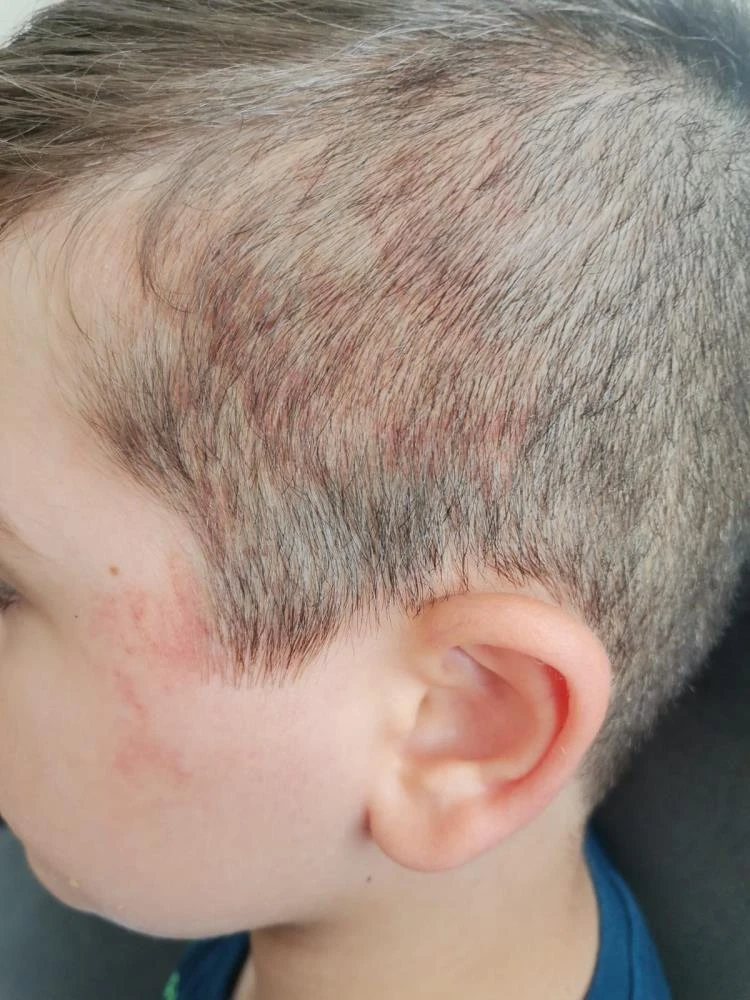 Tehlikeli oyun: 5 yaşındaki çocuk ölümden kıl payı kurtuldu