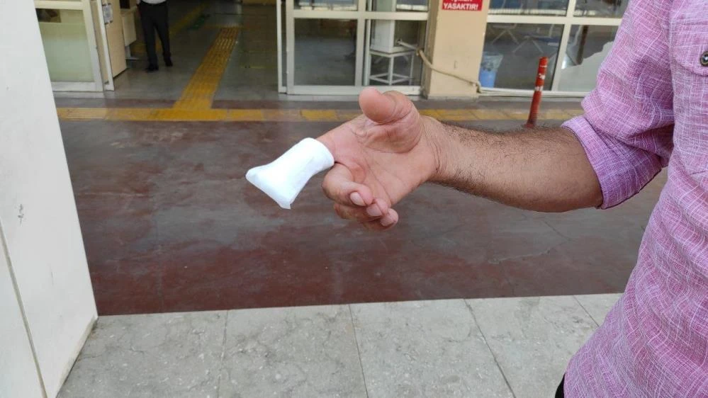 Acemi kasaplar kendilerini kestiler