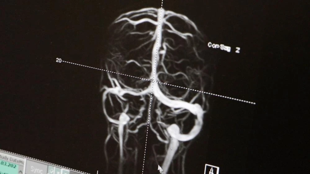 Doktor tesadüfen muayene etti: Küçük kız az kalsın kör olacakmış