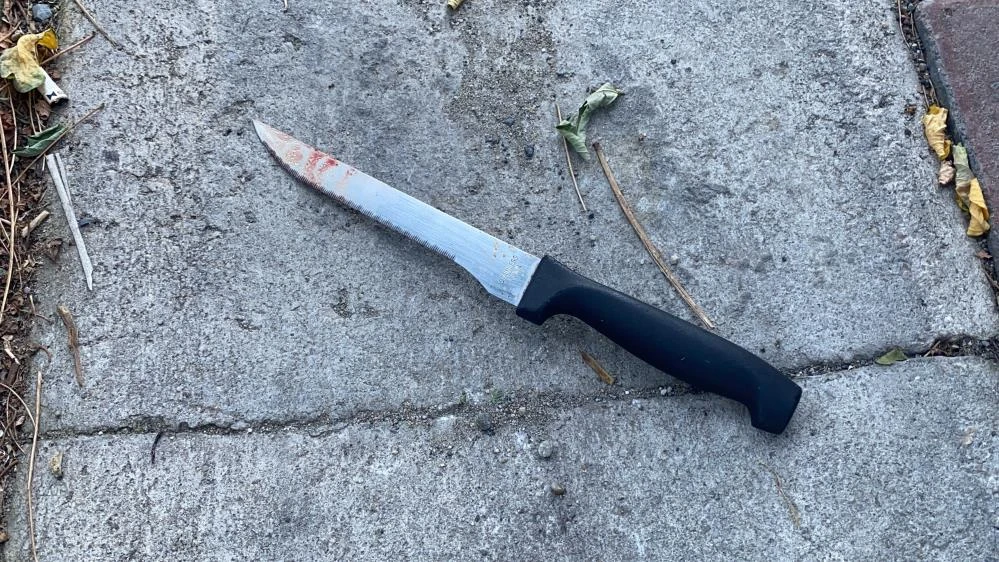 Erkek arkadaşı tarafından bıçaklanan kadın şikayetçi olmadı