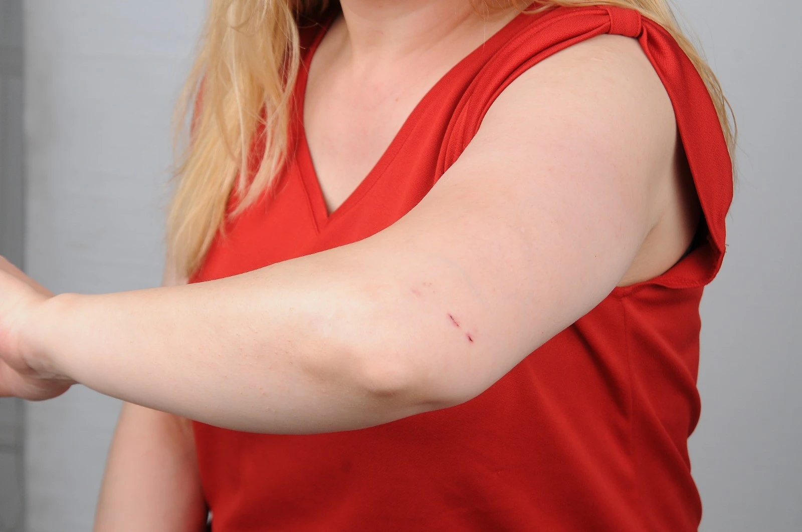 Kadın hasta hemşireye saldırarak saçlarını yoldu