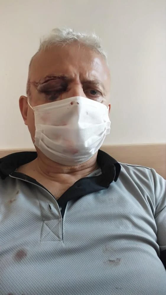 Maske uyarısında bulunduğu şahıs kör etti