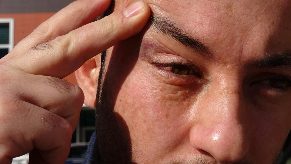 Sıraya kaynak yapmak isteyen hasta yakınından sağlık çalışanına yumruklu saldırı