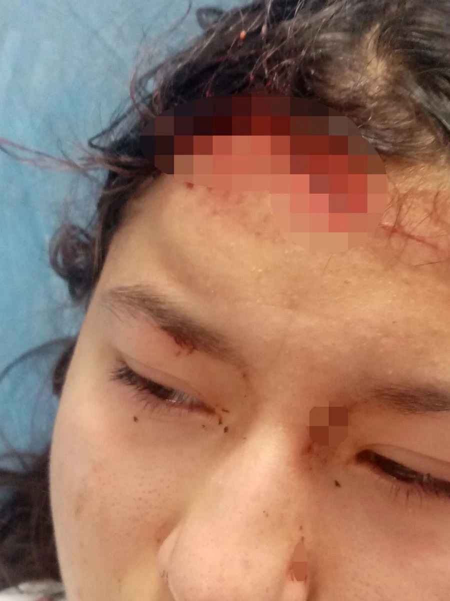 Karı görüp dışarıda fotoğraf çekilmeye çıkan çocuk köpeklerin saldırısına uğradı