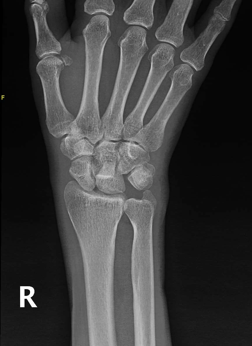 Röntgen filmiyle şehirler arası soygun