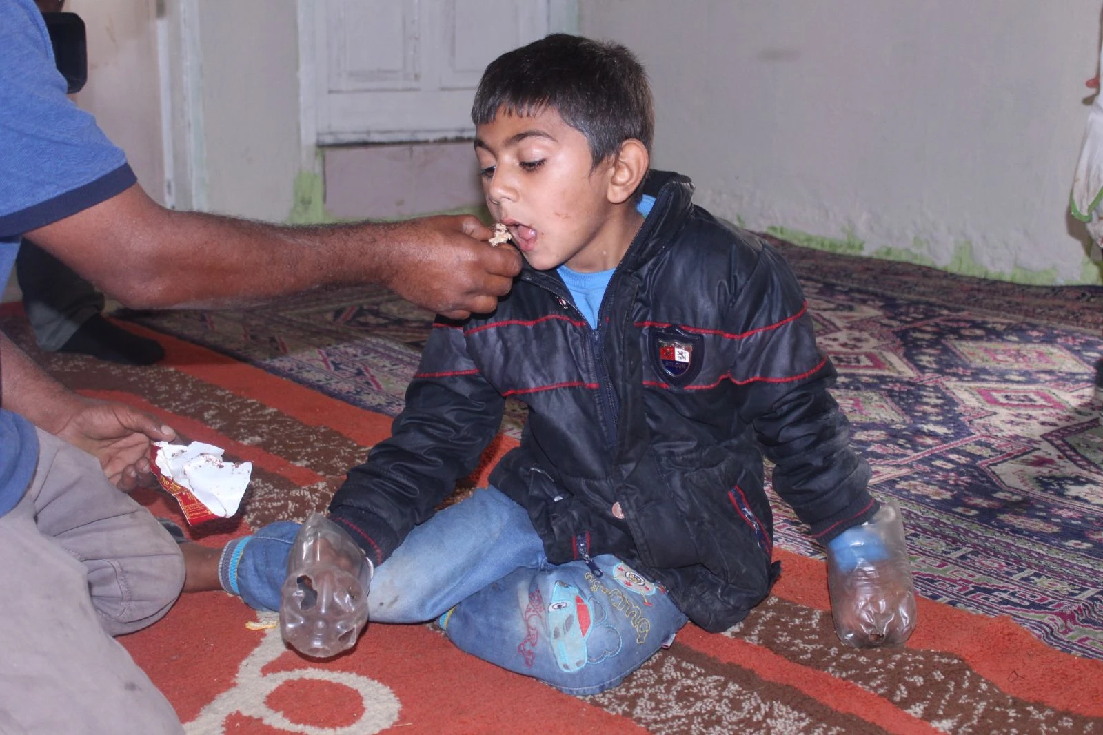 Minik Yusuf'un dramı: Ailesi ellerini plastik şişeye bağlıyor