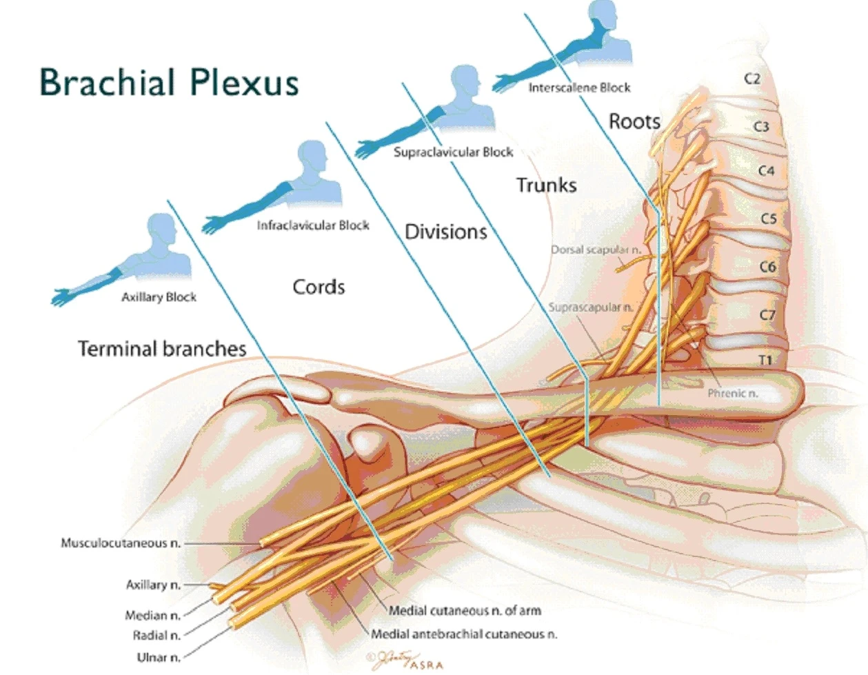 Doğumsal Brakial Pleksus Hasarı nedir? Brakial Pleksus Doktor Hatası mı?