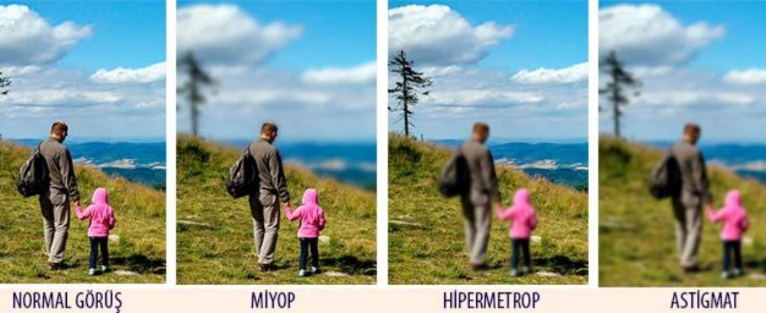 Astigmat Nedir?, Astigmat Olup Olmadığımı Nasıl Anlarım?