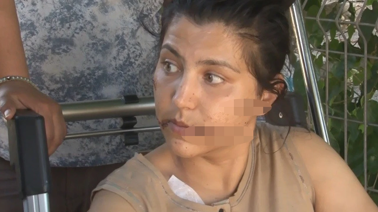 100 yerinden bıçaklanan kadın yaşadığı dehşeti böyle anlattı