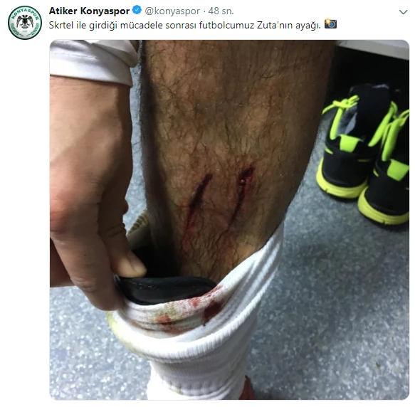 Konyaspor'dan Skrtel'in müdahalesine büyük isyan! Ayağı bu hale geldi