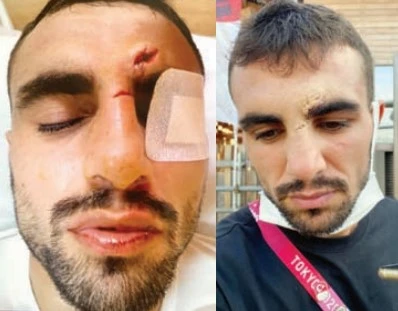 Tokyo’da bir madalyamız tabelaya çarptı!