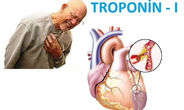 Kalp Sağlığının Anahtarı: Troponin