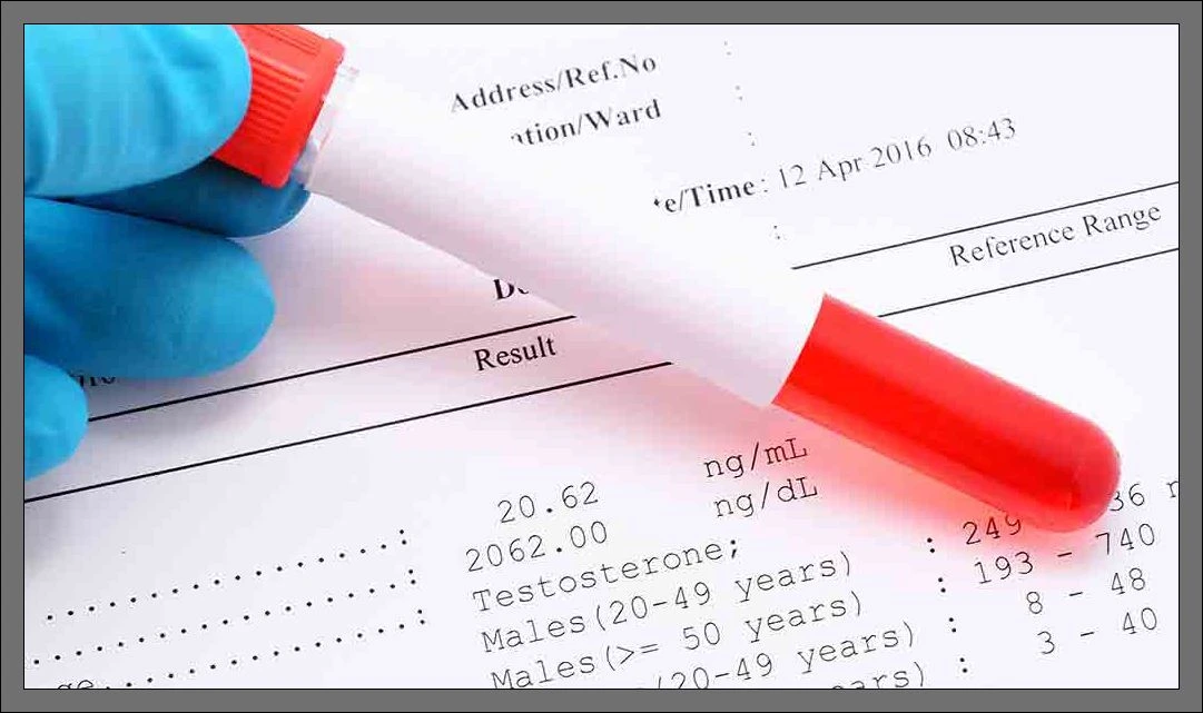 Kanda UİBC Nedir? UİBC Düşüklüğü, Yüksekliği Ve Normal Değerleri Nasıldır?