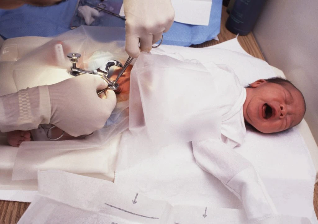 Bezli bebeklerde sünnet sonrası bakım nasıl olmalıdır? Yenidoğan bebeklerde sünnet