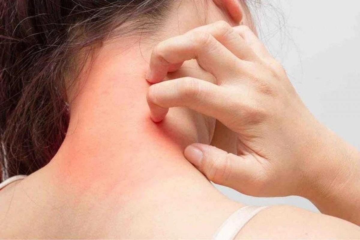 Alerji Nedir? Alerjen Nedir? Solunum Yolları Alerjilerinin Sebepleri Nelerdir?