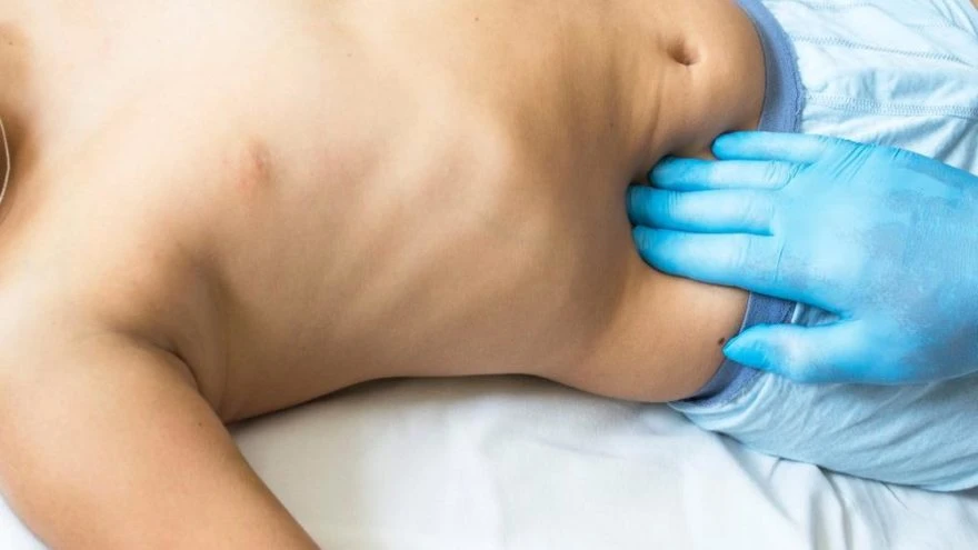 Evde Apandisit Testi Çoçuklarda Apandisit Belirtileri Nedir?